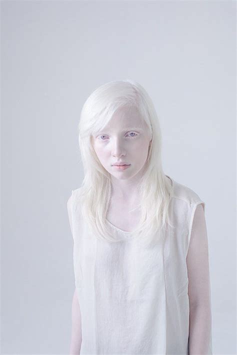 Albino By Anna Danilova Albino Model Albino Girl Pale Beauty