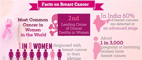 Inflammatory breast cancer can be an uncommon kind of breast cancer. Breast Cancer - Causes, Risks, Symptoms, Diagnosis ...