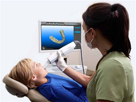 Itero® Intraoral Scanner Nyberg Orthodontics