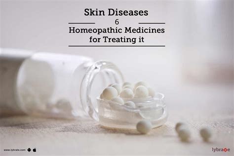 Skin Diseases 6 Homeopathic Medicines For Treating It By Dr Greeva