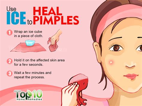 8 Home Remedies For Pimples And Prevention Tips Emedihealth Akne