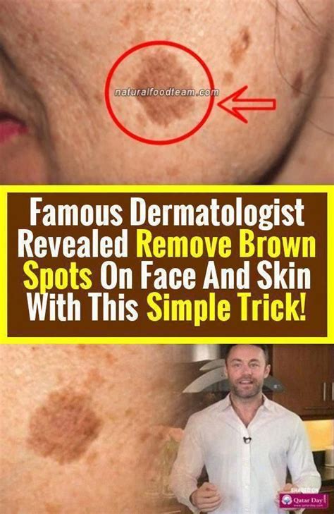 How To Get Rid Of Brown Spots On Face Creamforbrownspots