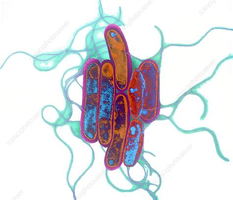 Where do legionella bacteria come from? Legionella bacteria - Stock Image - B232/0032 - Science ...