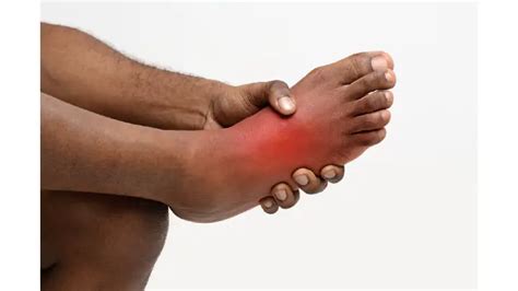 11 Causes Of Redness On The Bottom Of The Feet Treatments Africana
