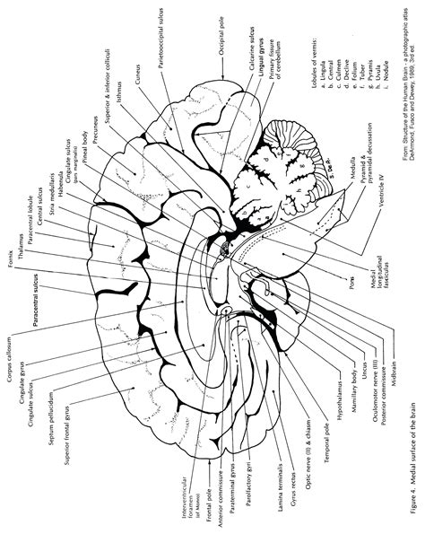 Midsagittal Section Brain Diagram To Label Blank Sketch Coloring Page