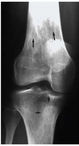 Knee Radiology Key