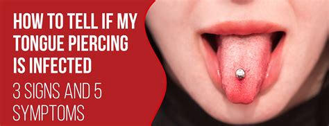 How To Tell If My Tongue Piercing Is Infected 3 Signs And 5 Symptoms Dr Numb®