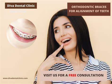 Pin On Orthodontic Treatment Bangalore