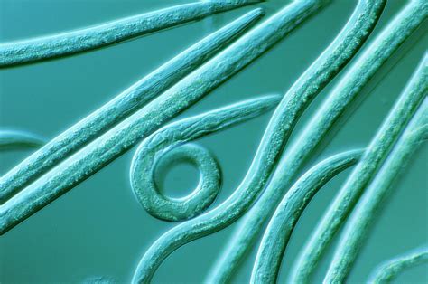 Lm Of The Nematode Worm Photograph By Sinclair Stammersscience Photo