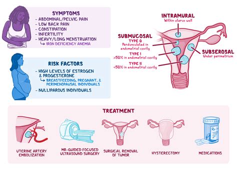 Osmosis Leiomyoma Of Uterus Uterine Fibroid What Is It Causes