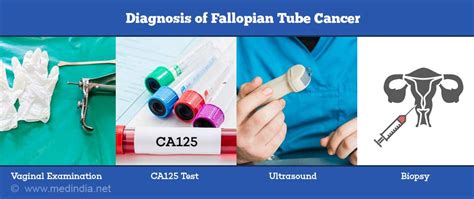 Fallopian Tube Cancer Medical Tech News The Latest Health News