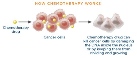Chemotherapy Lungevity Foundation