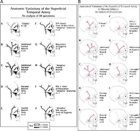 A Classification Of Superficial Temporal Artery Sta By Anatomic
