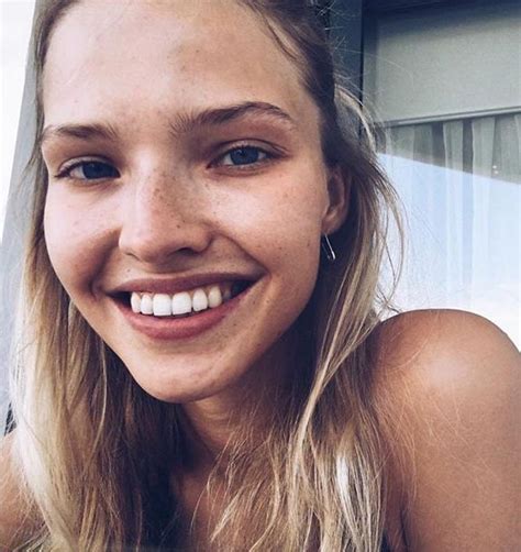 9 it girls flaunting their freckles this summer kylie jenner elsa hosk and more vogue