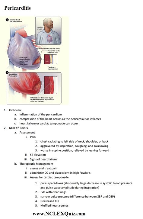 Nclex Cardiac Points Pericarditis Nclex Quiz
