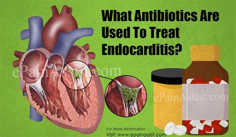 Endocarditis Antibiotic Treatment