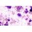 Microscope World Blog Mast Cell Tumor Mastocytoma In Dogs