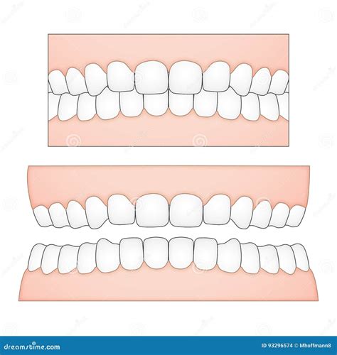 Vector Illustration Of White Teeth And Gums From A Frontal Perspective