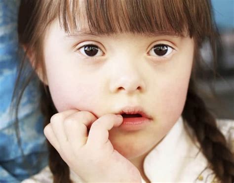 It's when there is an extra copy of chromosome 21 and can result in physical symptoms as well as. Myths and truths about the people with Down syndrome