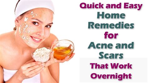 How To Get Rid Of Acne Scars In 3 Days How To Prevent Acne And Pimple