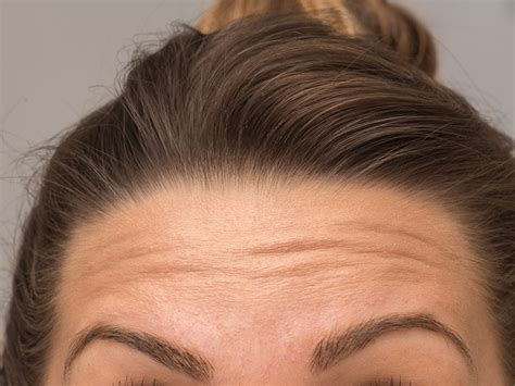 What Your Facial Wrinkles May Be Trying To Tell You Best Health