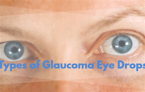 Glaucoma Eye Drops Side Effects Dock Pharmacy