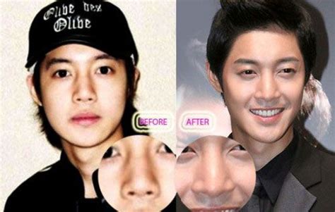 Pin On Celebrity Before And After