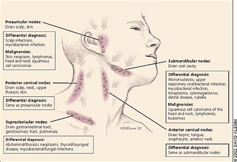 Miles To Read B4 I Sleep Level 2 A And 2b Cervical Lymph Node Cv Ln Levels