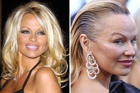 Pin By Ann Beauregard On Stars Of Yesterday And Today Bad Celebrity Plastic Surgery Celebrity
