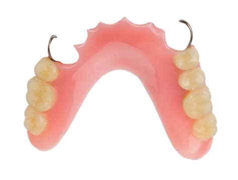 What Are My Replacement Options If I Have Missing Teeth Implants