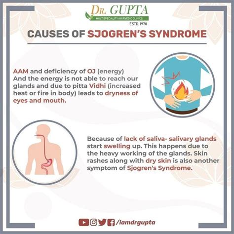 Causes Of Sjogrens Syndrome Sjogrens Syndrome Ayurvedic Clinic