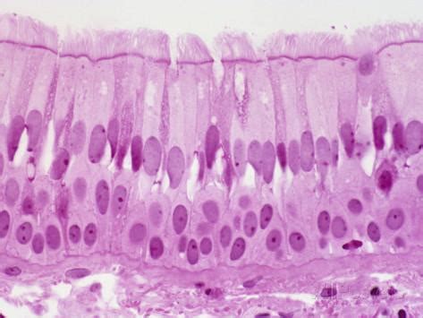 Find out information about pseudostratified ciliated columnar epithelium. Tissues - Honors Anatomy And Physiology with Deikun at ...