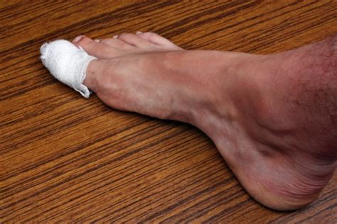 How To Know You Have An Infected Toe Nagy Footcare