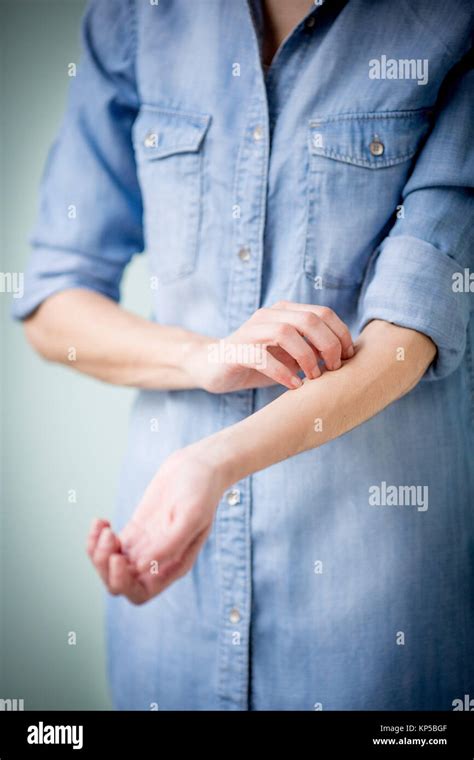 Woman Itching Her Arm Stock Photo Alamy