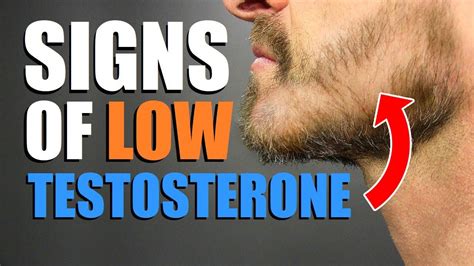 7 Signs You Have Low Testosterone Levels Under 30 Years Old Youtube