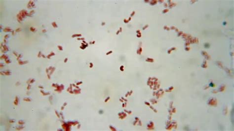 Microscope View Of Bacteria Youtube
