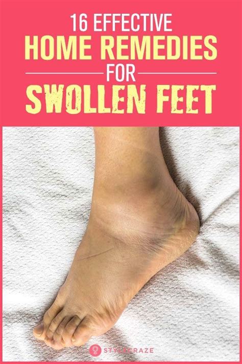 16 Effective Home Remedies For Swollen Feet In 2020 Foot Remedies