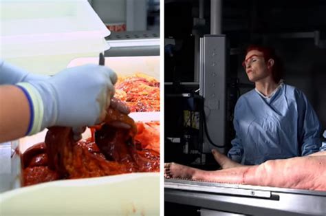 Bbc Three To Shock With Human Autopsy On Obesity The Post Mortem Daily Star