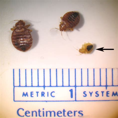 Bed Bug Outbreaks Are Real Heres What Experts Want You To Know