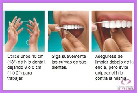 Clínica Dental El Carmen ¿cuál Es El Modo Correcto De Utilizar El Hilo