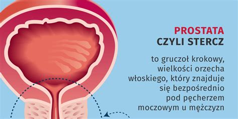 Prostata co musisz o niej wiedzieć a boisz się zapytać INFOGRAFIKA Zdrowie