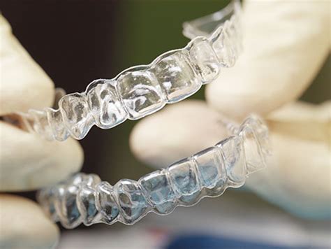 Invisalign In Clearwater Doerner Dental