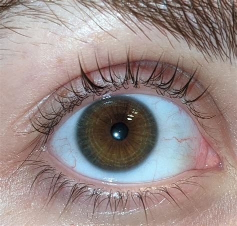 Teeny Tiny Eye Freckle Eyes