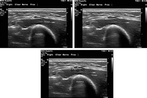 Normative Values For The Sonographic Measurement Of The Pediatric