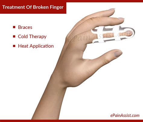 Broken Finger Treatment Causes Symptoms Signs