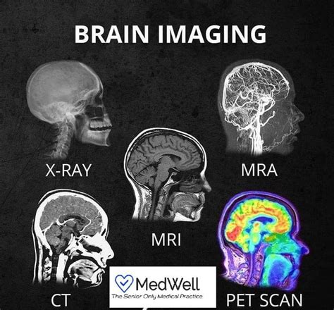 Head Brain Scan Types Brain Images Pet Scan Medical