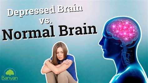 Depressed Brain Vs Normal Brain Youtube
