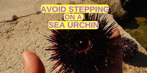 6 Tips To Avoid Stepping On A Sea Urchin Beach Life