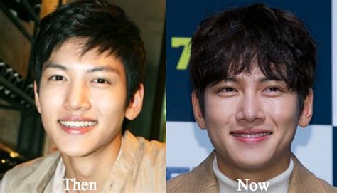 This surprising speculation popping on the internet had made public shocked when his appearance before the plastic surgery was compared to that after he had. Nam Ji Hyun Before And After Plastic Surgery