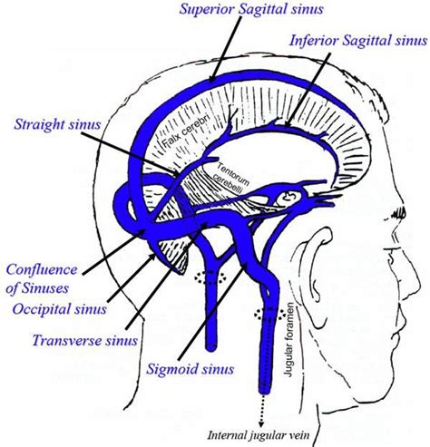 What Is Superior Sagittal Sinus Mapasgmaes